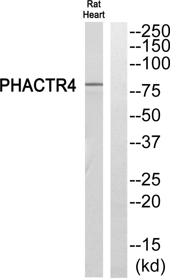 PHACTR4 Rabbit Polyclonal Antibody