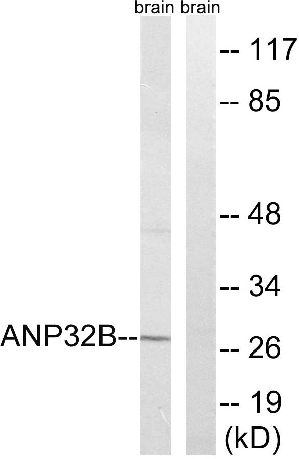 PHAPI2 Rabbit Polyclonal Antibody