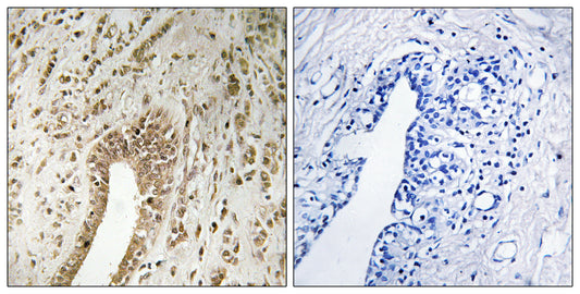 PHF3 Rabbit Polyclonal Antibody