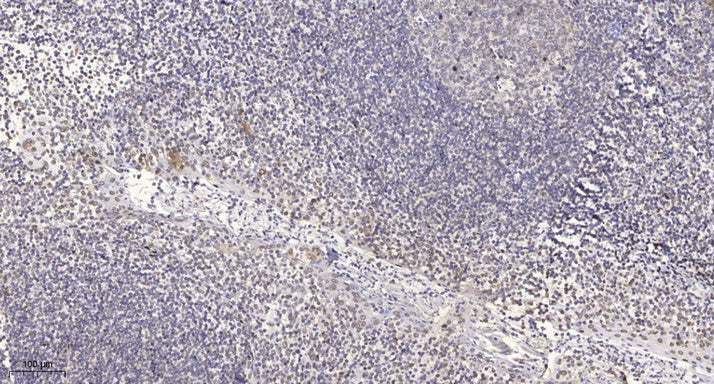 PHI-1 Rabbit Polyclonal Antibody