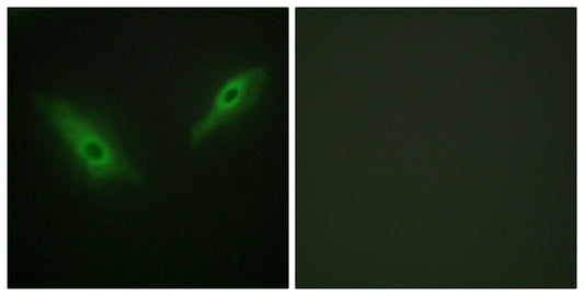 PHKA1/2 Rabbit Polyclonal Antibody