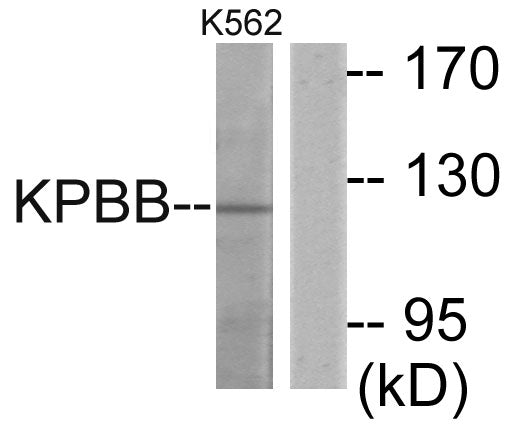 PHKB Rabbit Polyclonal Antibody