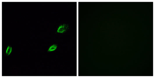 Photomedin-1 Rabbit Polyclonal Antibody