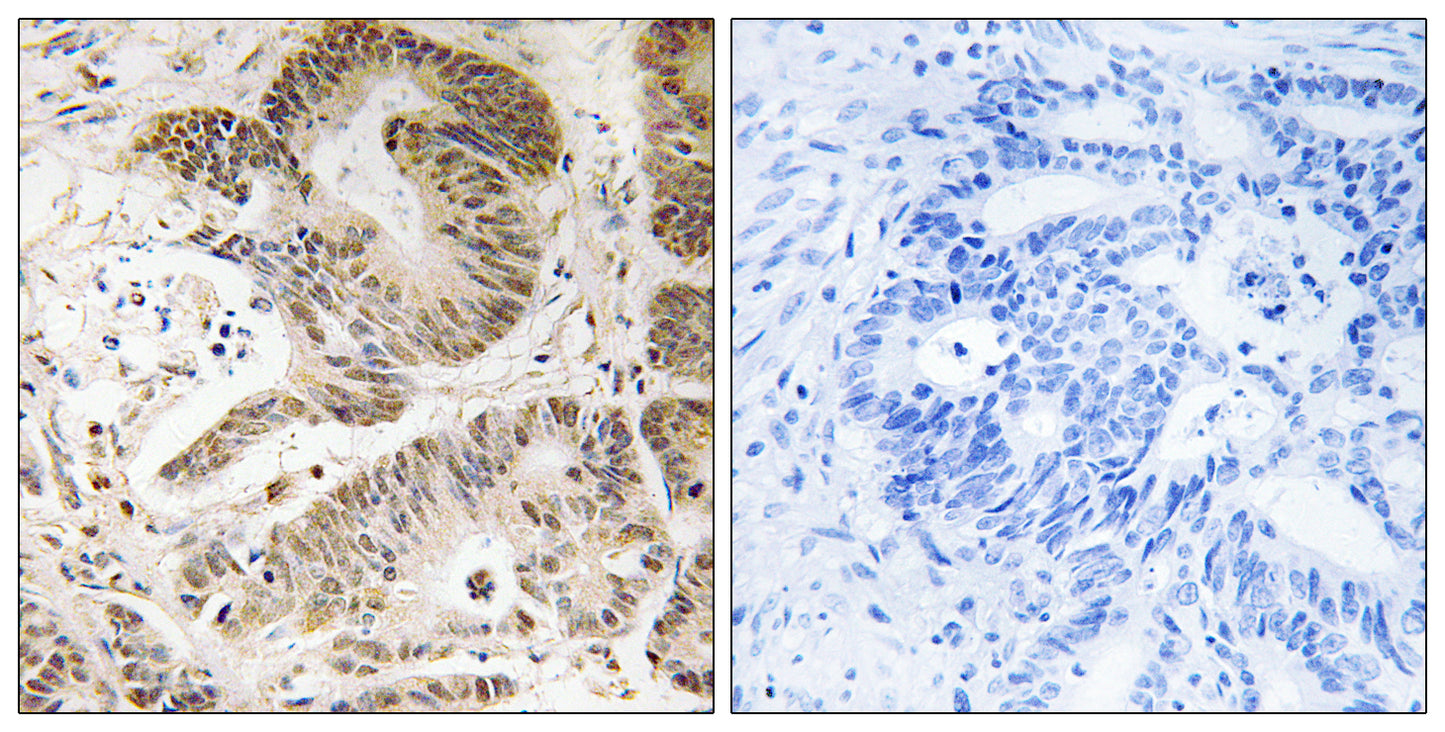 PI 3-kinase p101 Rabbit Polyclonal Antibody