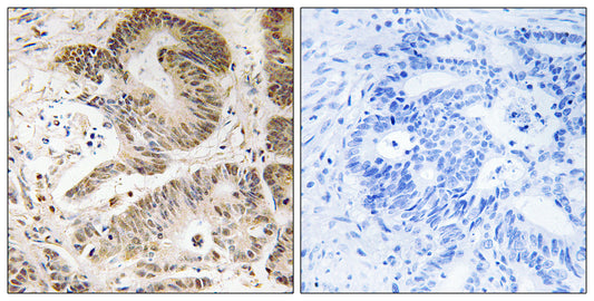 PI 3-kinase p101 Rabbit Polyclonal Antibody