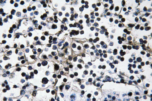PI 3-kinase p110α Rabbit Polyclonal Antibody