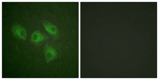 PI 3-kinase p85α Rabbit Polyclonal Antibody