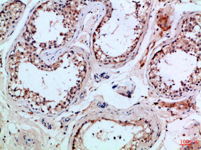 PI 3-Kinase p85β Rabbit Polyclonal Antibody