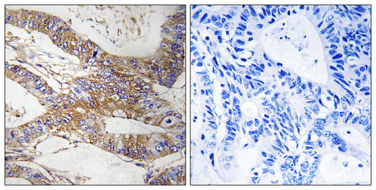 PI-9 Rabbit Polyclonal Antibody