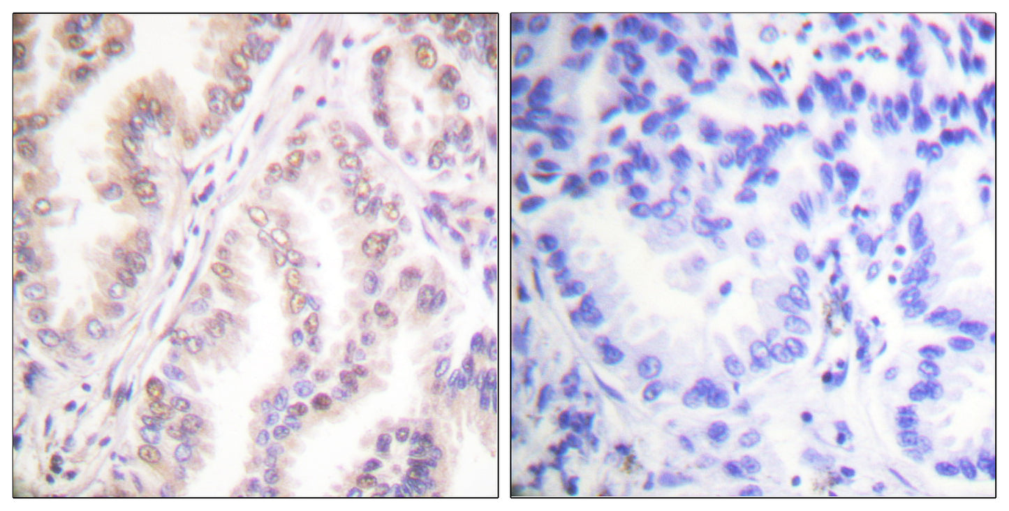 PIAS 1 Rabbit Polyclonal Antibody