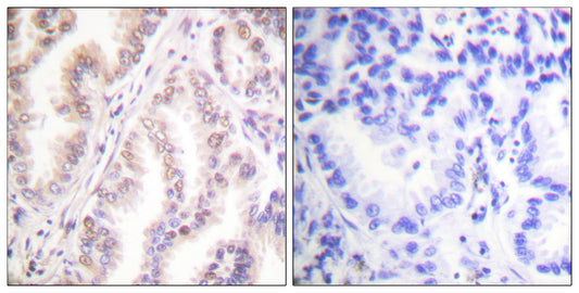 PIAS 1 Rabbit Polyclonal Antibody