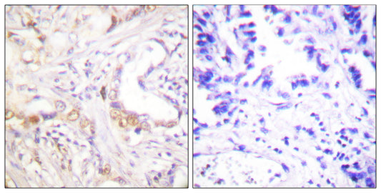 PIAS 3 Rabbit Polyclonal Antibody