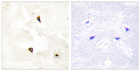 PIG11 Rabbit Polyclonal Antibody