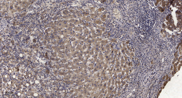 PIG-F Rabbit Polyclonal Antibody