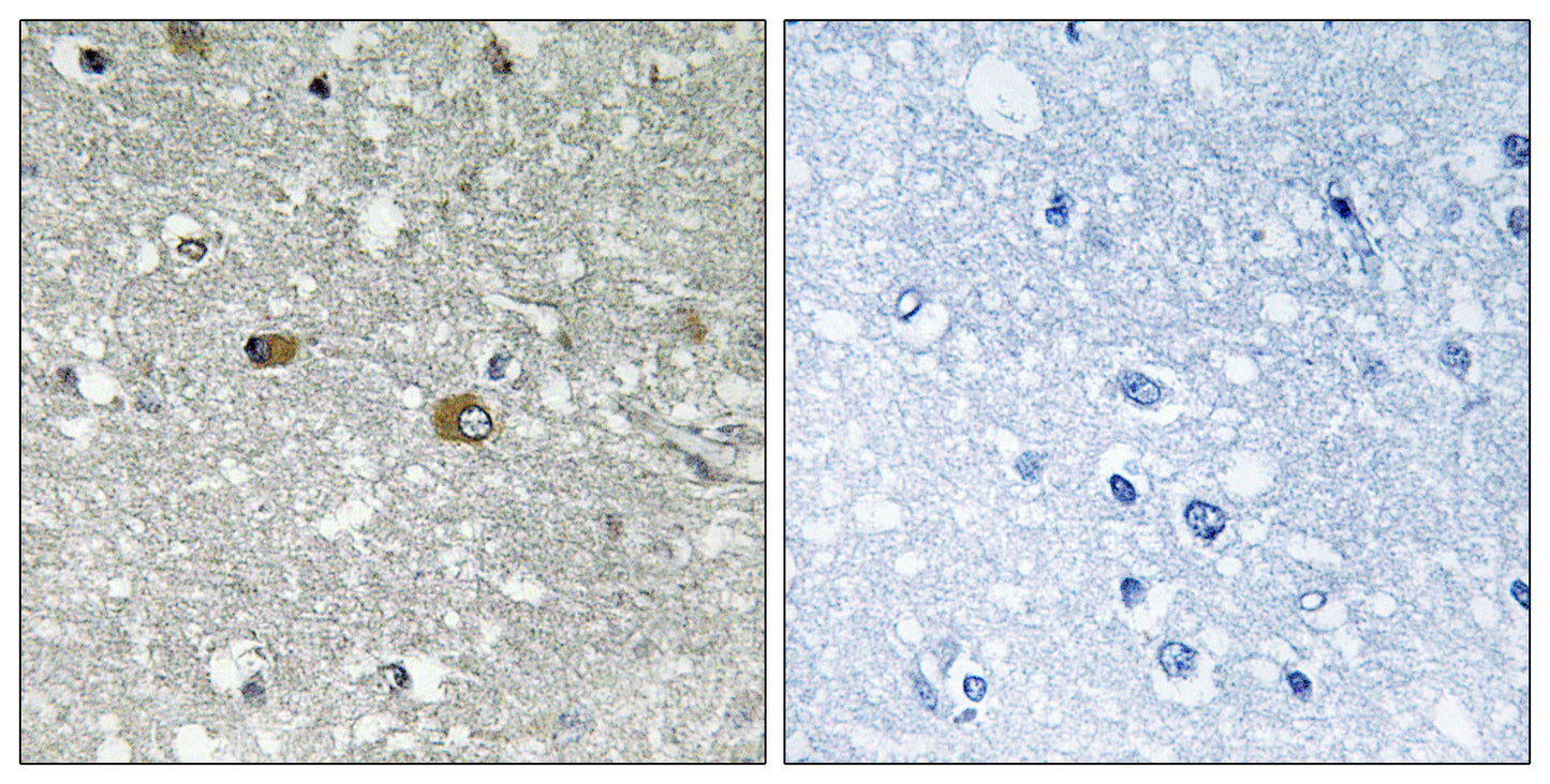 PIG-H Rabbit Polyclonal Antibody