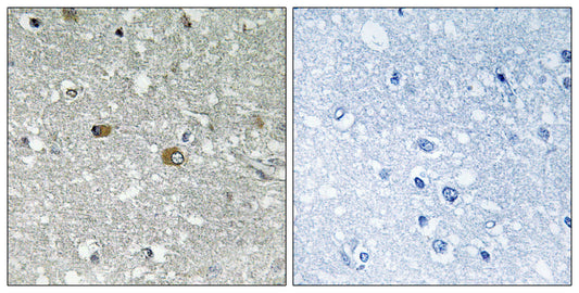 PIG-H Rabbit Polyclonal Antibody