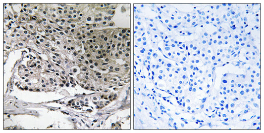 PIG-Y Rabbit Polyclonal Antibody
