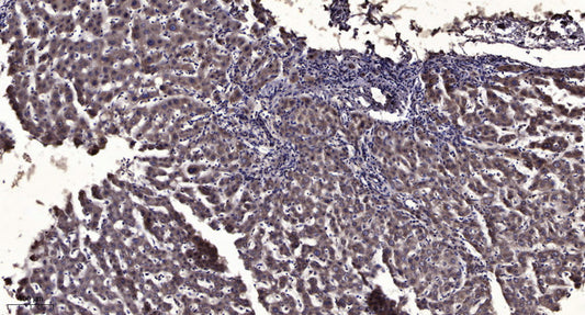 Pim-2 Rabbit Polyclonal Antibody