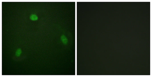 Pin1 Rabbit Polyclonal Antibody