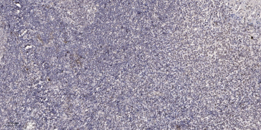 PinX1 Rabbit Polyclonal Antibody
