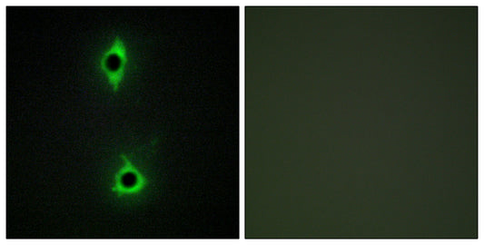 PIP5KIII Rabbit Polyclonal Antibody
