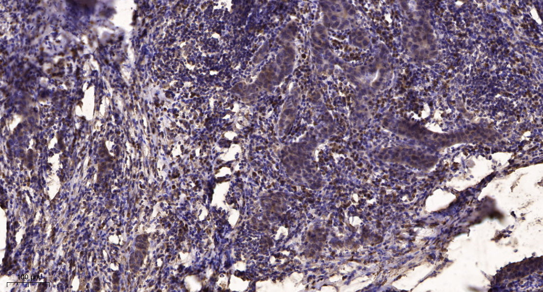 PITPα Rabbit Polyclonal Antibody