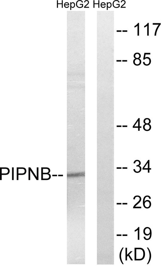 PITPβ Rabbit Polyclonal Antibody