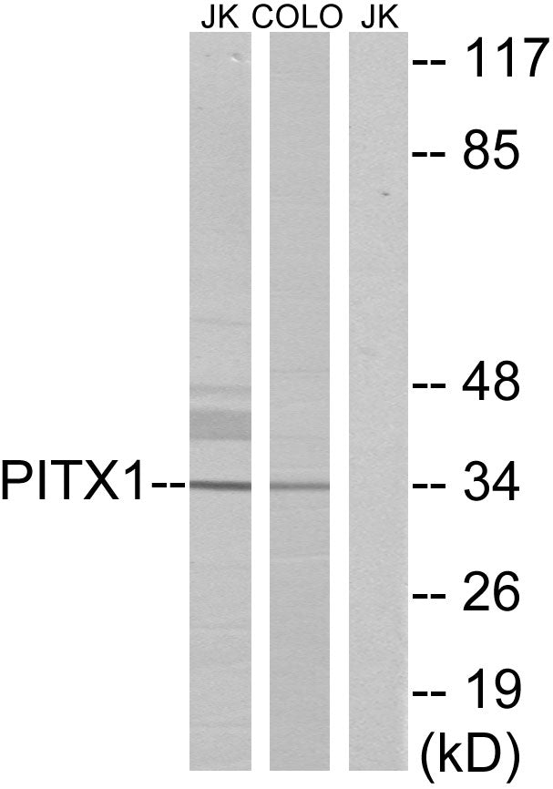 Pitx1 Rabbit Polyclonal Antibody
