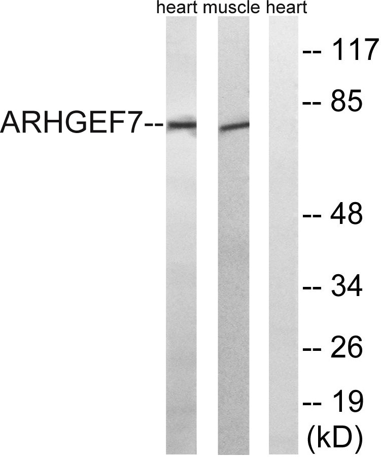 PIXβ Rabbit Polyclonal Antibody