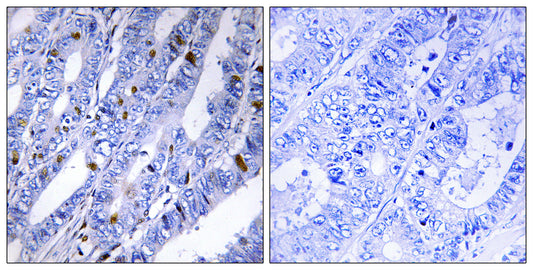 PKA IIβ reg Rabbit Polyclonal Antibody