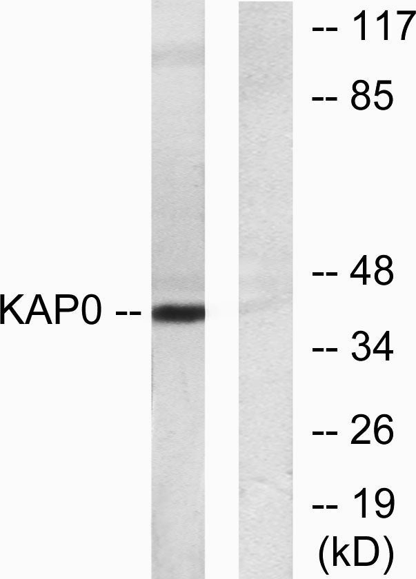 PKA Iα reg Rabbit Polyclonal Antibody