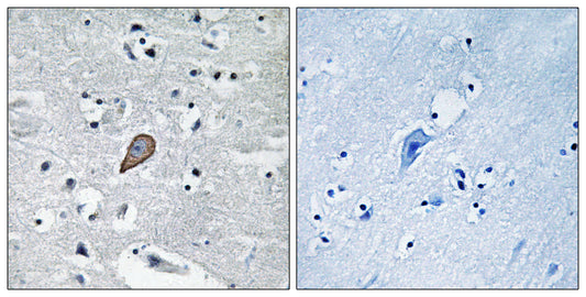 PKC θ Rabbit Polyclonal Antibody