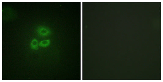 PKD1 Rabbit Polyclonal Antibody