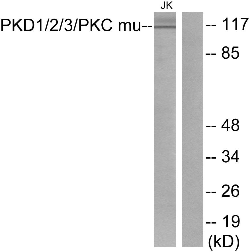 PKD1/2/3 Rabbit Polyclonal Antibody