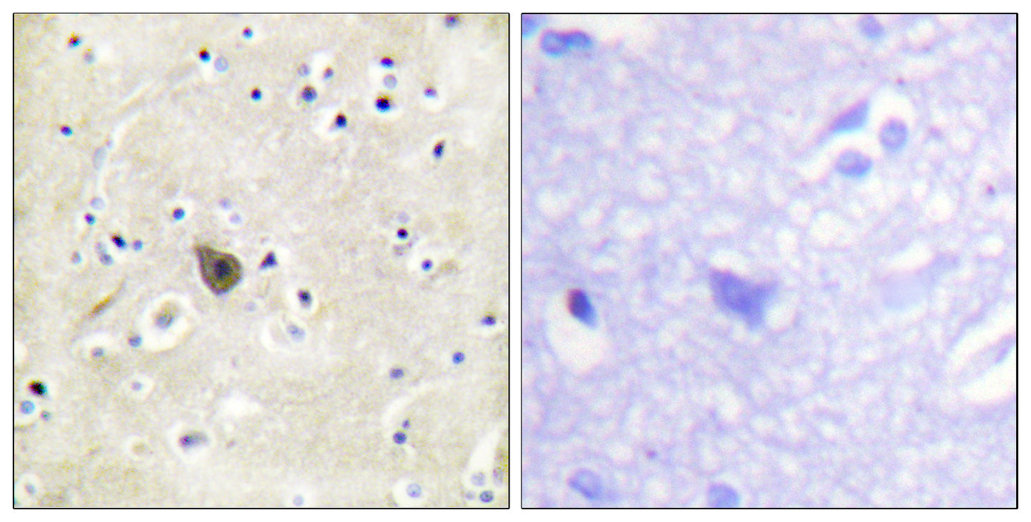 PKD2 Rabbit Polyclonal Antibody