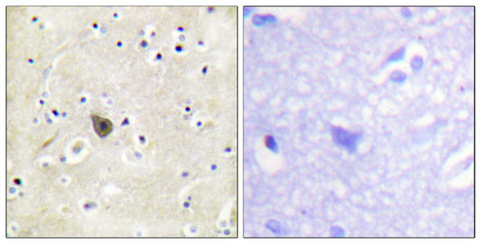 PKD2 Rabbit Polyclonal Antibody