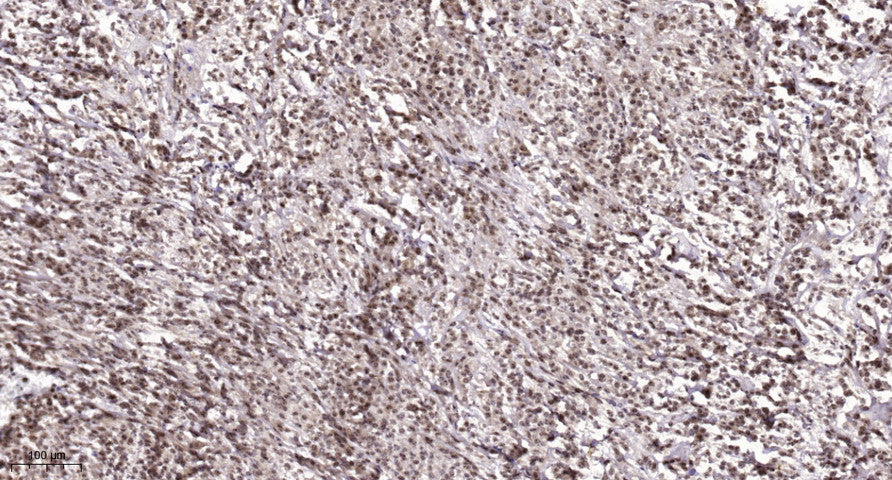 PKIG Rabbit Polyclonal Antibody