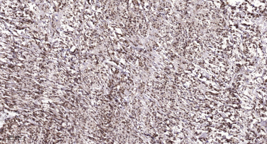 PKIG Rabbit Polyclonal Antibody