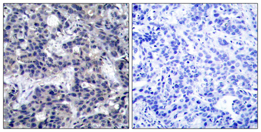 PKR Rabbit Polyclonal Antibody