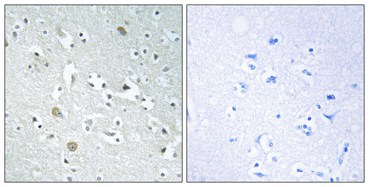 PLA1A Rabbit Polyclonal Antibody