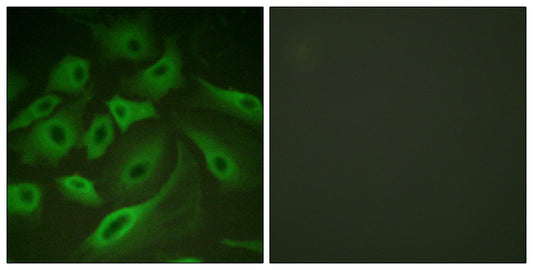 PLB Rabbit Polyclonal Antibody