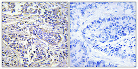 PLC-XD1 Rabbit Polyclonal Antibody