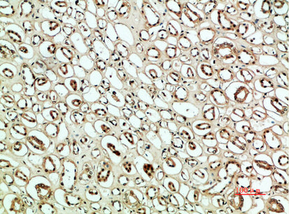 PLK2 Rabbit Polyclonal Antibody