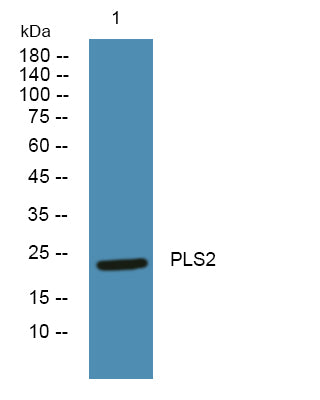 PLS2 Rabbit Polyclonal Antibody
