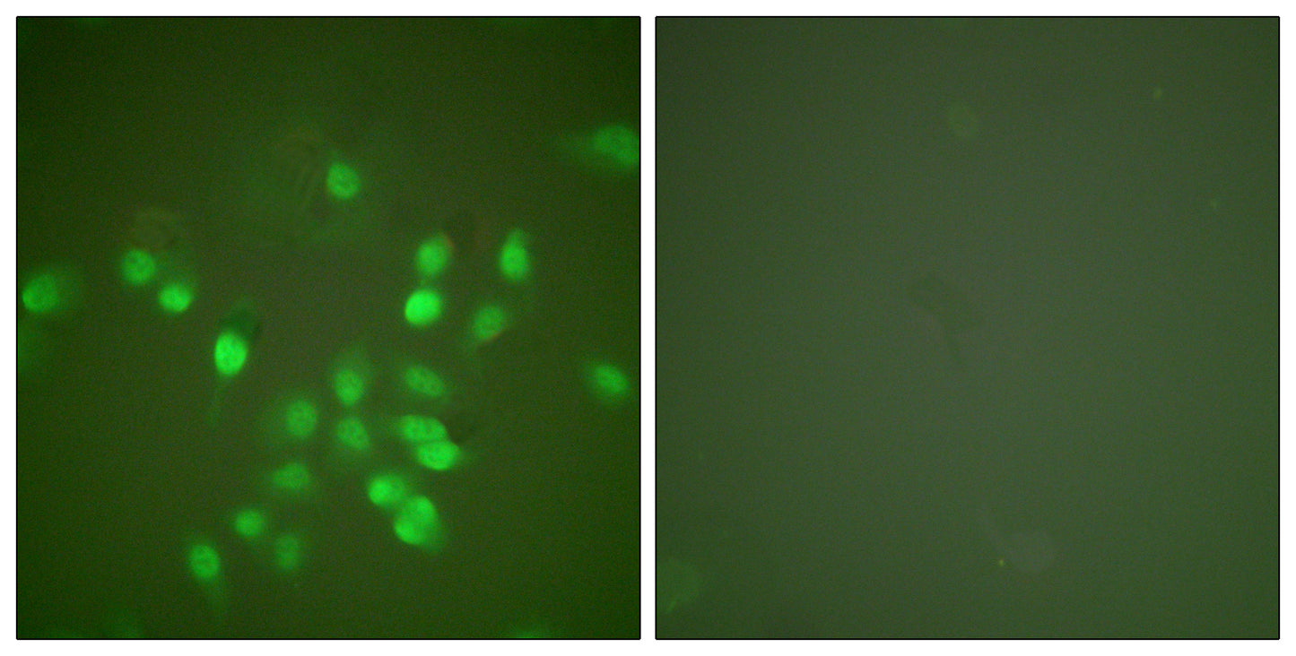 PML Rabbit Polyclonal Antibody