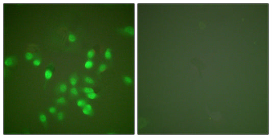 PML Rabbit Polyclonal Antibody