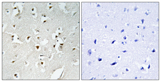 PMS1 Rabbit Polyclonal Antibody