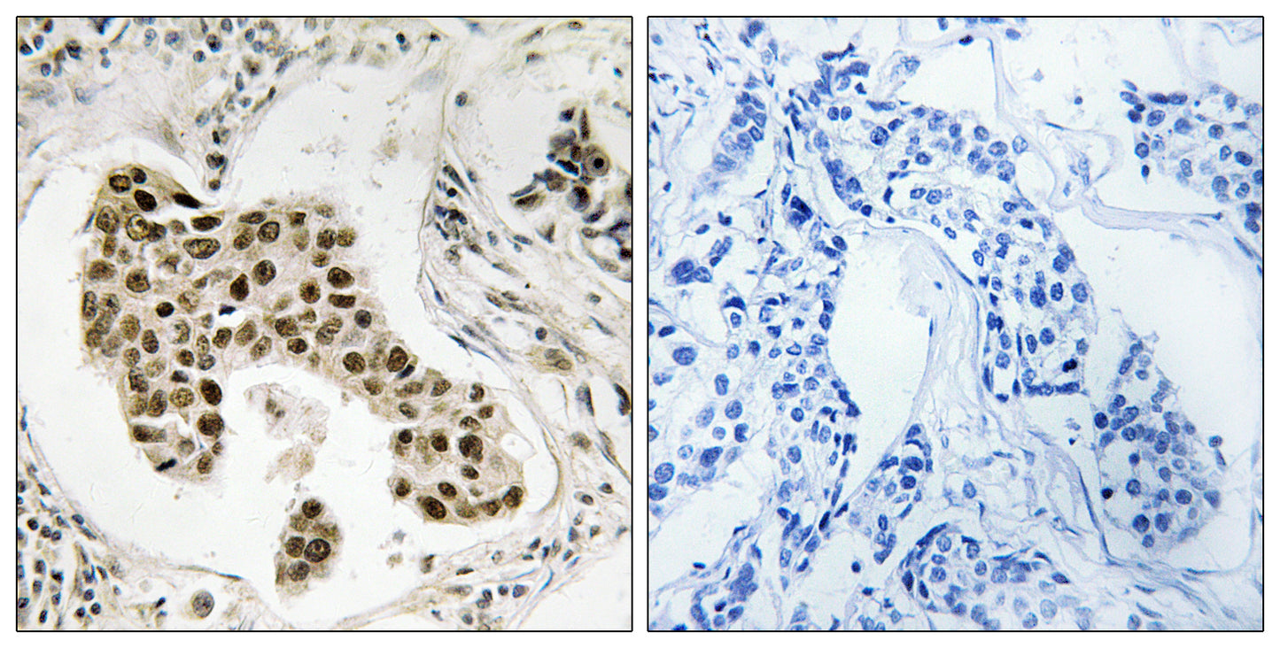 PMS2/PMS2CL Rabbit Polyclonal Antibody