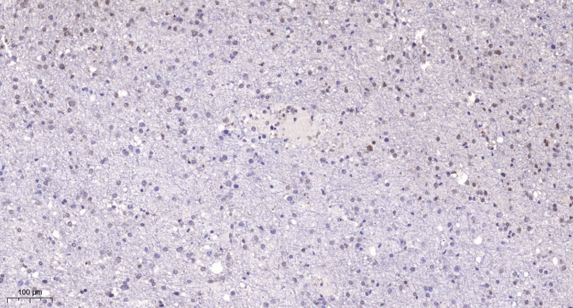 POLR1E Rabbit Polyclonal Antibody