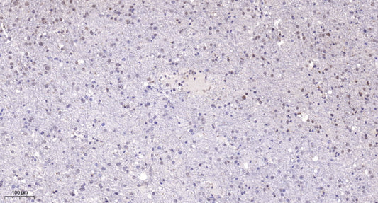 POLR1E Rabbit Polyclonal Antibody